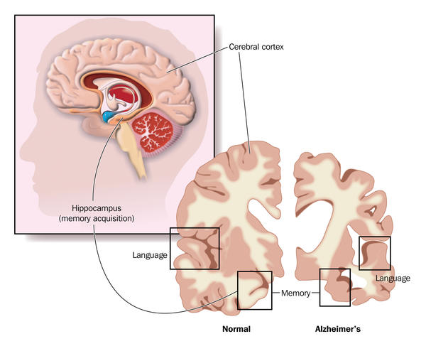 12th International Conference On Vascular Dementia And Dementia